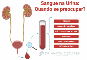 Sangue na Urina (Hematúria): Quando se preocupar? – Dr. Antônio Soares ...